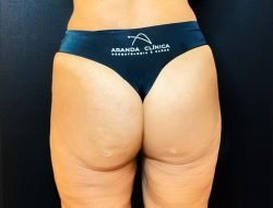 Bumbum Aranda Lift D